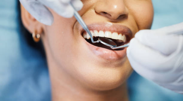 Best Emergency Dental Care for Broken or Chipped Teeth in Dunwoody, GA